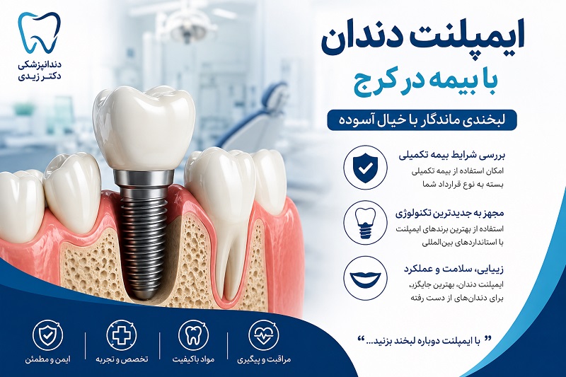 ایمپلنت دندان با بیمه در کرج